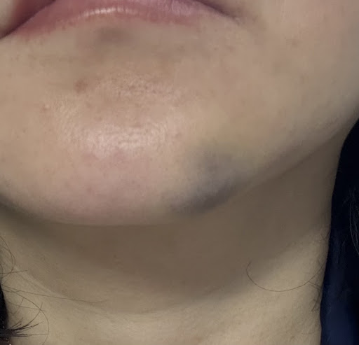 Game Over Brisbane 20250824 023448 004